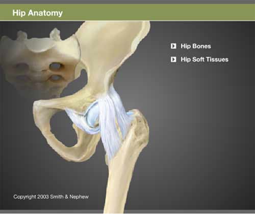 knee replacement screenshot