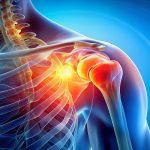 Rotator Cuff Injuries and its Treatments