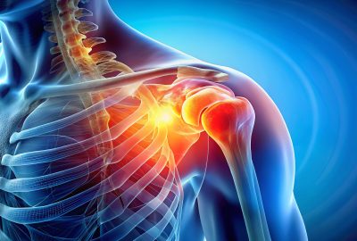 Rotator Cuff Injuries and its Treatments